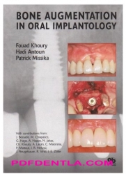 Bone Augmentation In Oral Implantology (pdf)